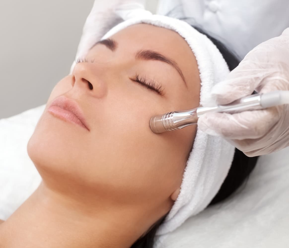 Microdermabrasion