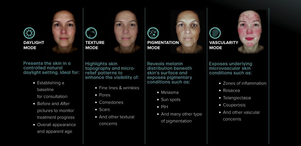 Different modes of OBSERV® skin analysis