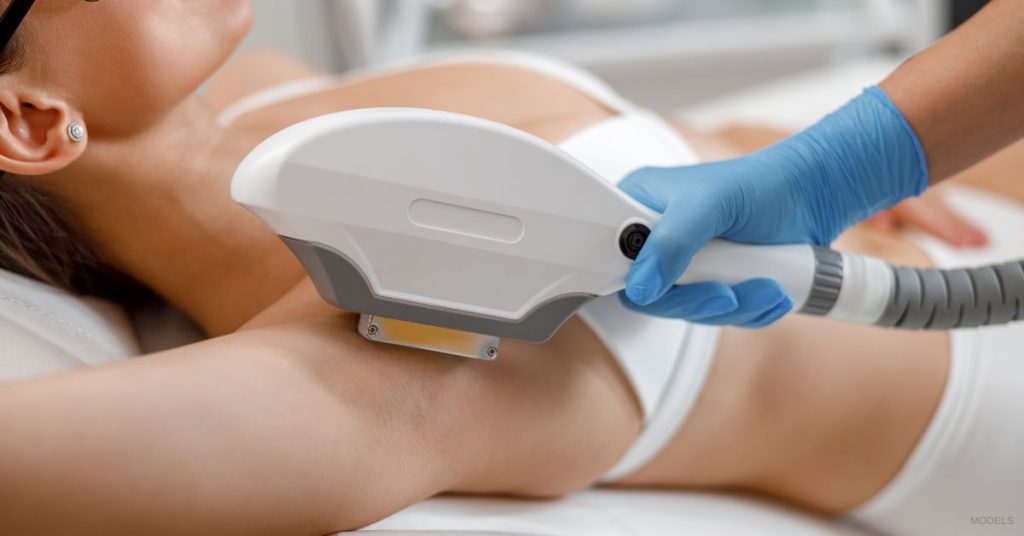 Woman receiving laser hair removal treatment on her armpits. (MODEL)