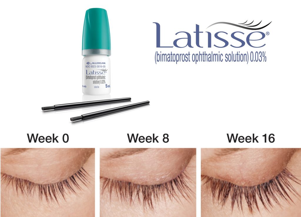 Picture of Lash growth