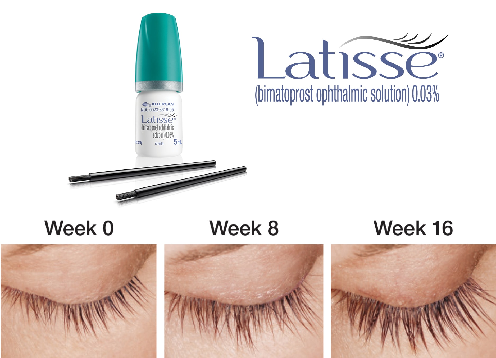 November Product Promotion: 20% OFF Latisse