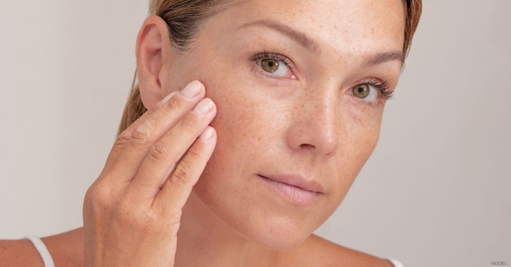 Woman touching her face (model)