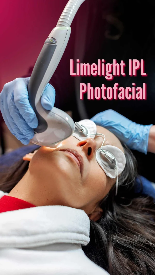 Fall is the season of renewal, making it the perfect time to give your skin a fresh start🍂

Our Limelight IPL Photofacial goes beyond surface beauty, it targets sun spots, freckles, redness, and uneven pigmentation, helping to restore balance and clarity from within. The result? A brighter, more youthful complexion with minimal downtime, so you can get back to enjoying the season feeling refreshed and confident ✨

Think of it as pressing the “reset” button after months of sunshine, so your skin feels clear, confident, and ready for the cooler months ahead.

📞 (705) 721-7775
🌐 SpaLumina.com

#SpaLumina #BarrieSpa #FallSkinRefresh #IPLPHotofacial