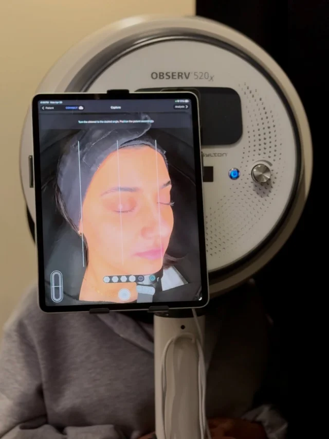 Most people are treating their skin based on what they think they see

But the truth is
many skin concerns begin long before they become visible

OBSERV® skin analysis allows us to look beneath the surface
revealing early pigmentation, dehydration, vascular changes, and underlying damage that can’t be seen with the naked eye

This is where skincare becomes more intentional✨

Instead of guessing products or treatments
we’re able to guide you based on what your skin actually needs now and long term

Because better results don’t come from doing more
they come from doing what’s right for your skin